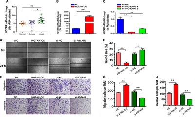 LncRNA HOTAIR regulates cell invasion and migration in endometriosis through miR-519b-3p/PRRG4 pathway